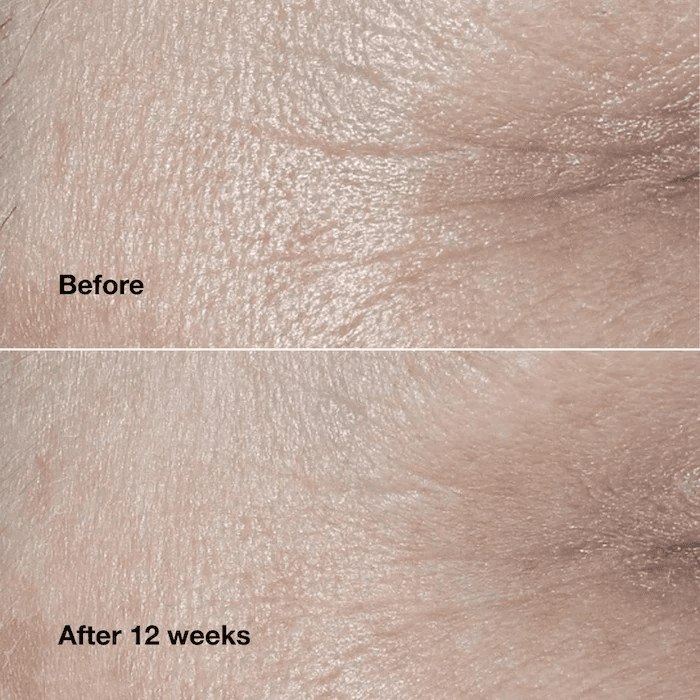 Clinique Clinique Smart Clinical Repairtm Wrinkle Correcting Cream 2