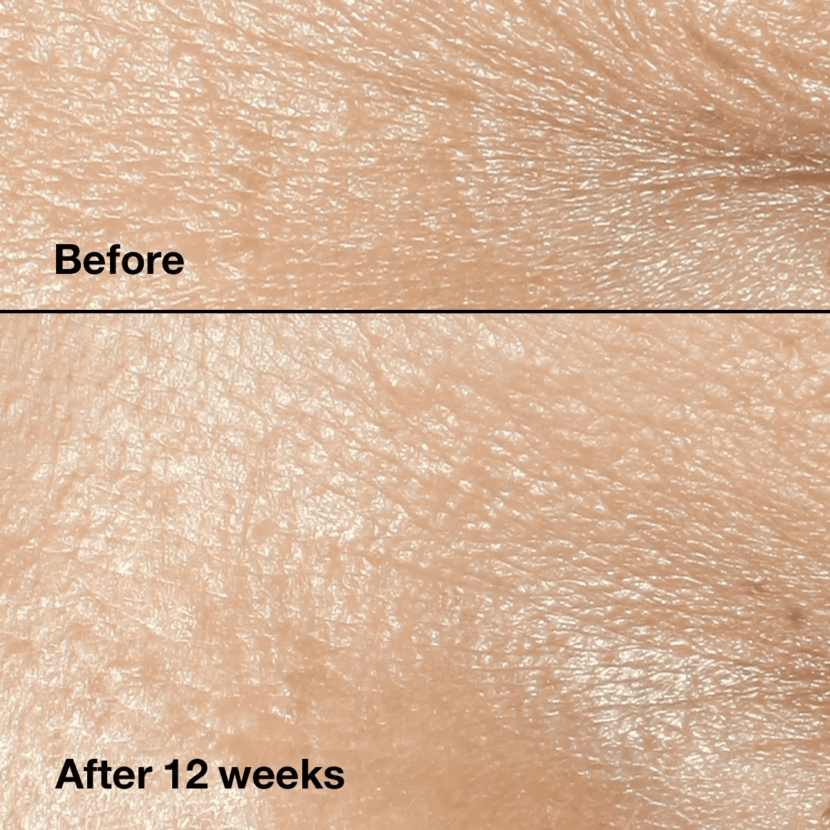 Clinique Clinique Smart Clinical Repairtm Wrinkle Correcting Cream 4