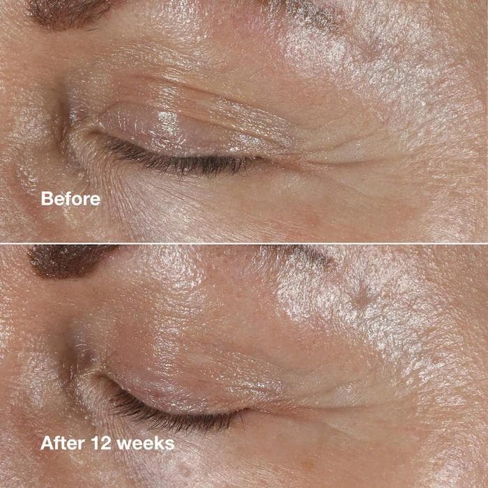 Clinique Clinique Smart Clinical Repairtm Wrinkle Correcting Eye Cream 5