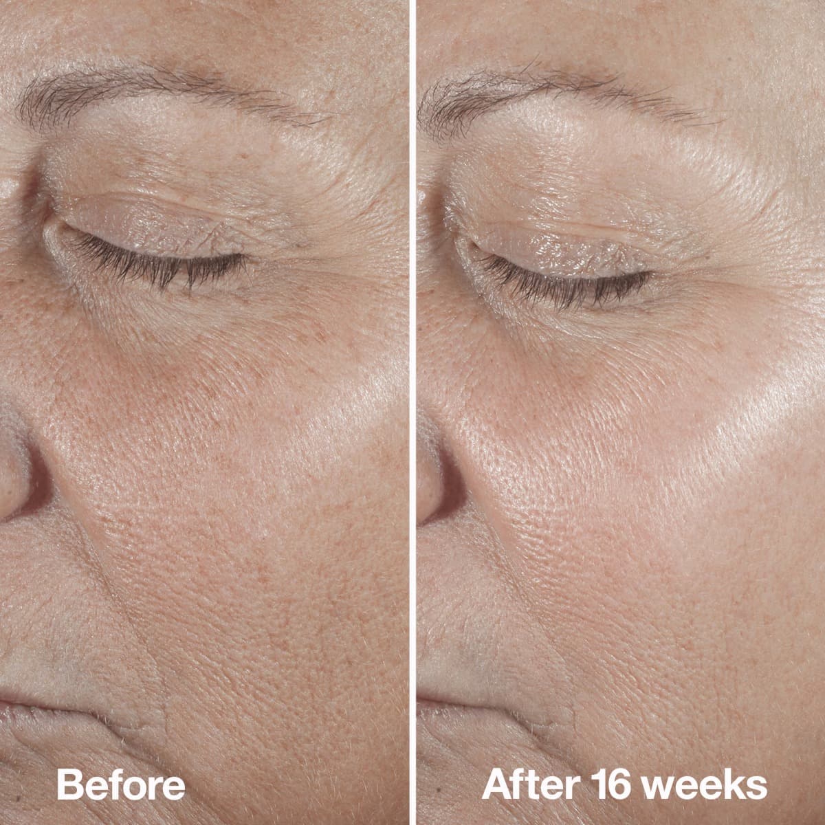 Clinique Clinique Smart Clinical Repairtm Wrinkle Correcting Serum 2