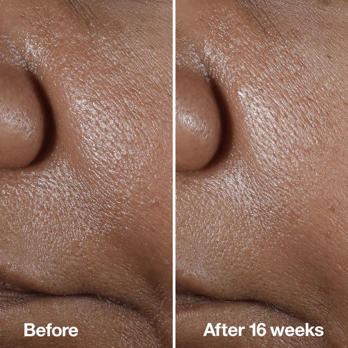 Clinique Clinique Smart Clinical Repairtm Wrinkle Correcting Serum 4