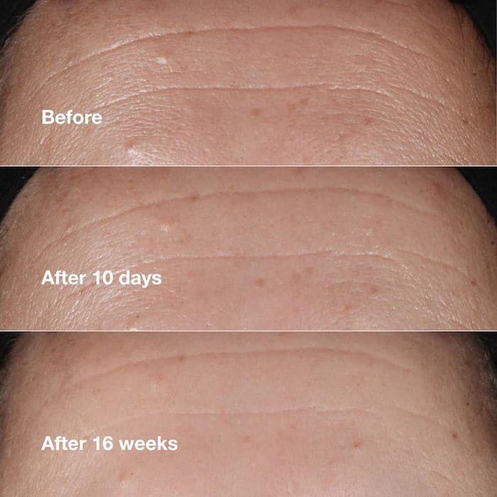 Clinique Clinique Smart Clinical Repairtm Wrinkle Correcting Serum 6