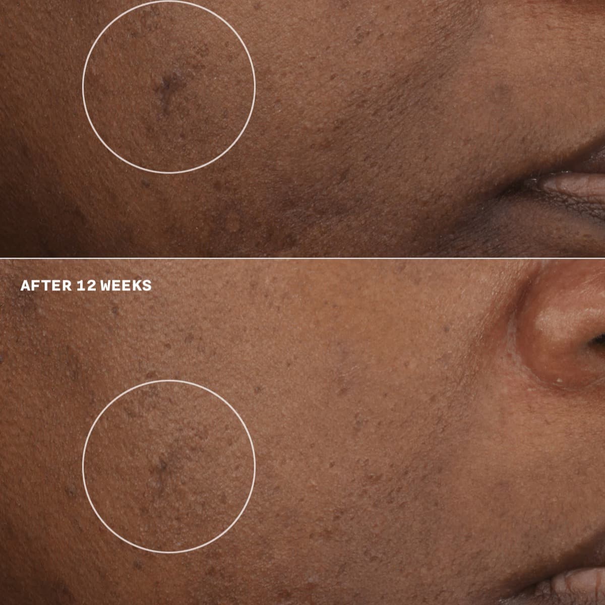 Clinique Even Better Clinicaltm Brightening Moisturizer 2