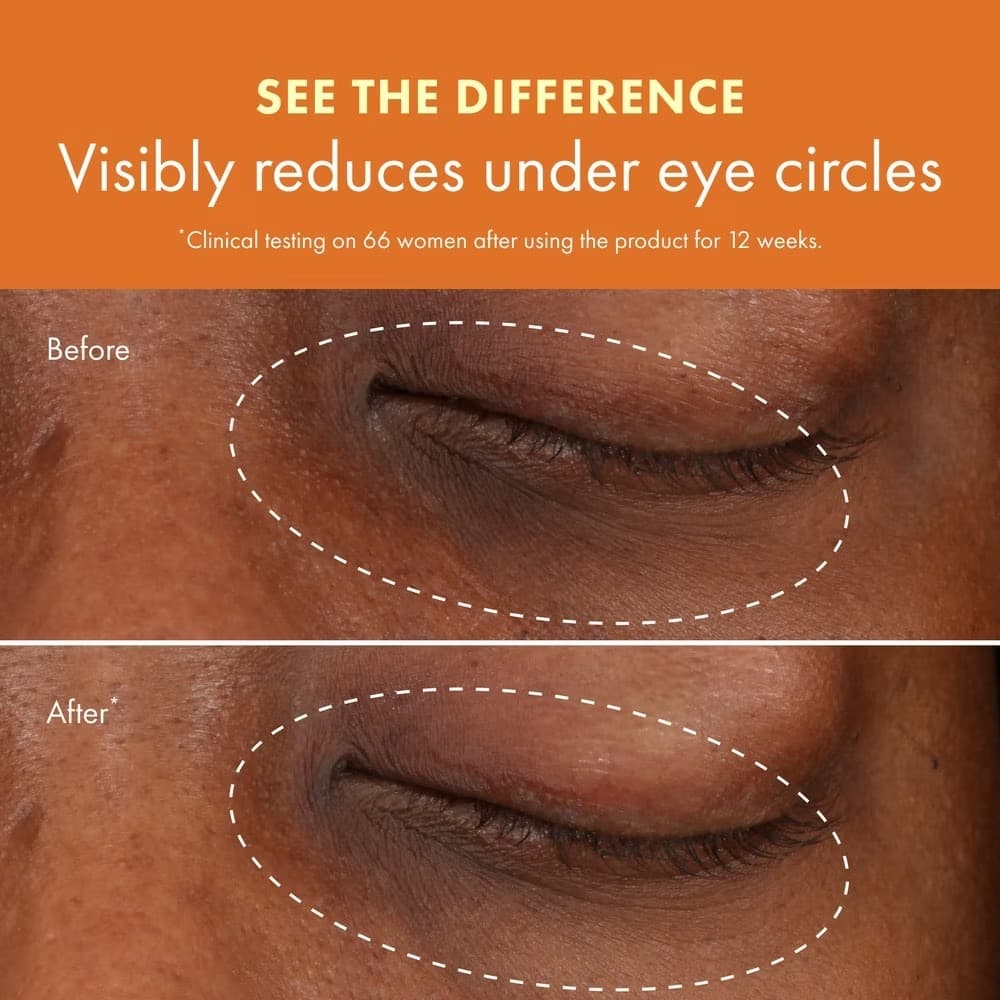 Origins Brightening Eye Cream With Vitamin C Niacinamide 6